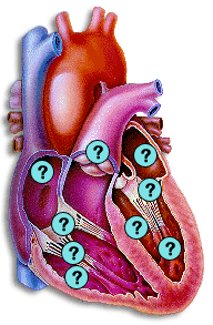 Cutaway